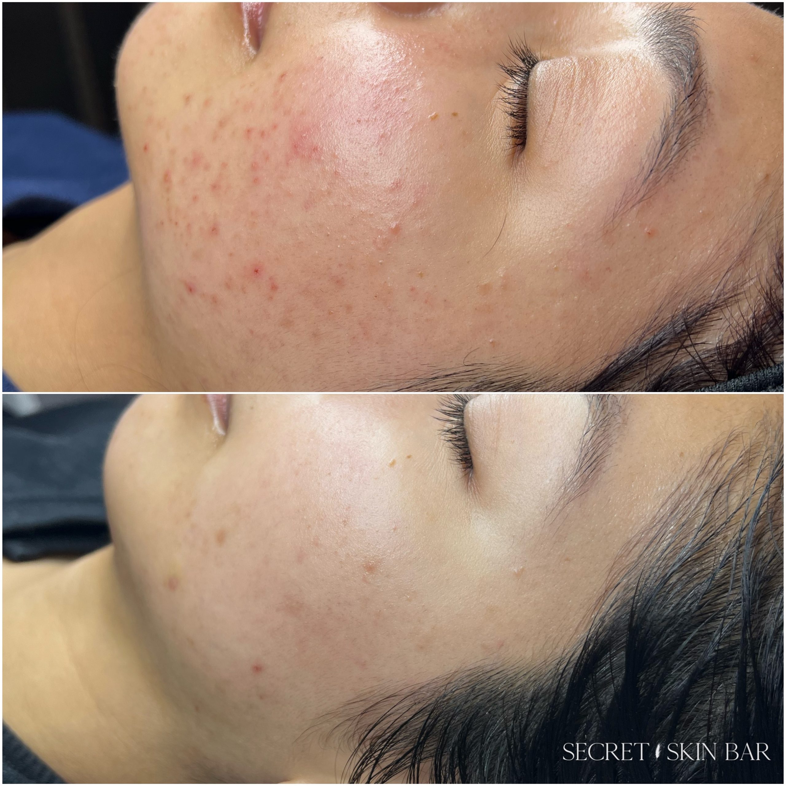 Client skin treatment photo 7