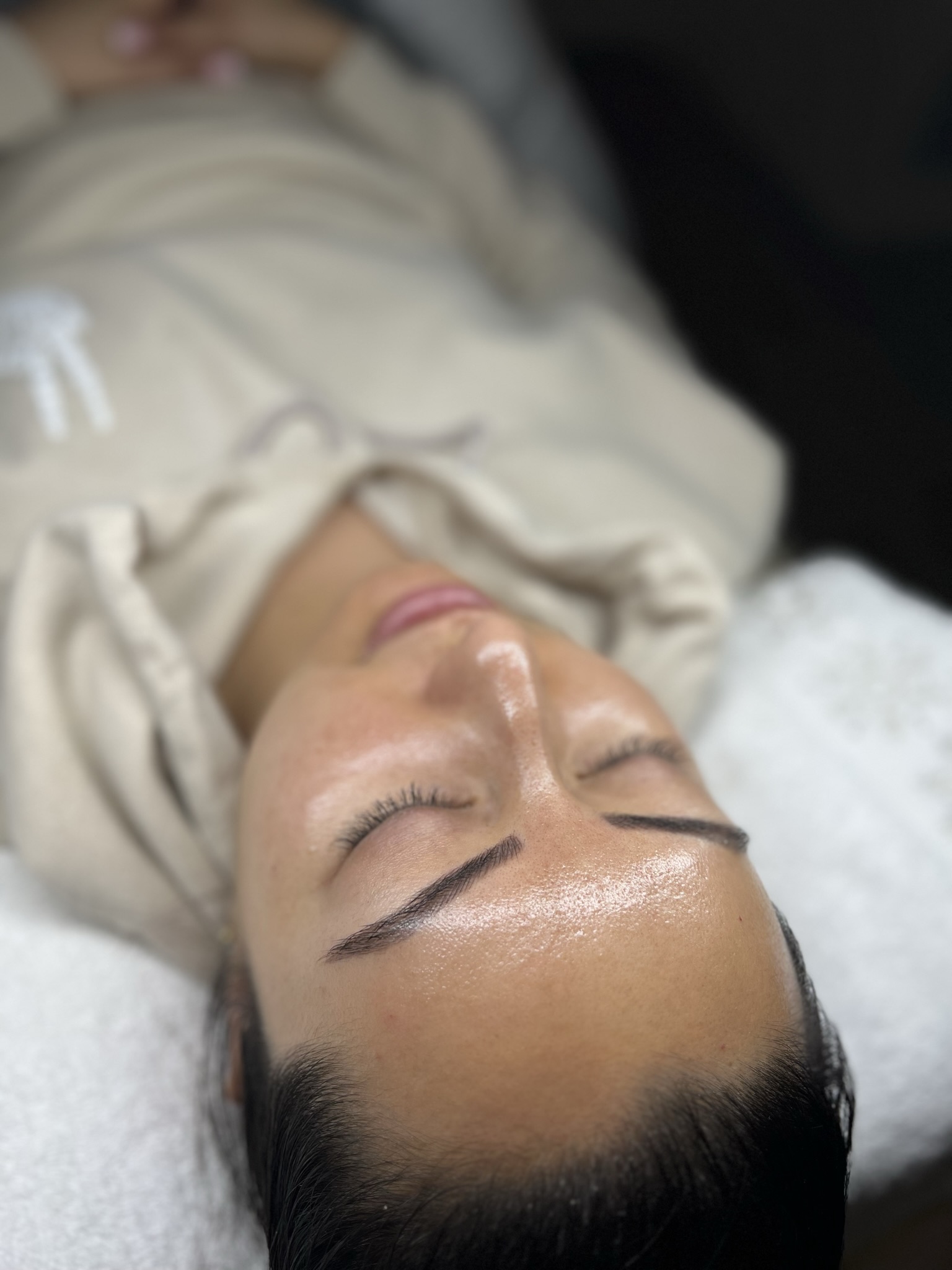 Client skin treatment photo 16