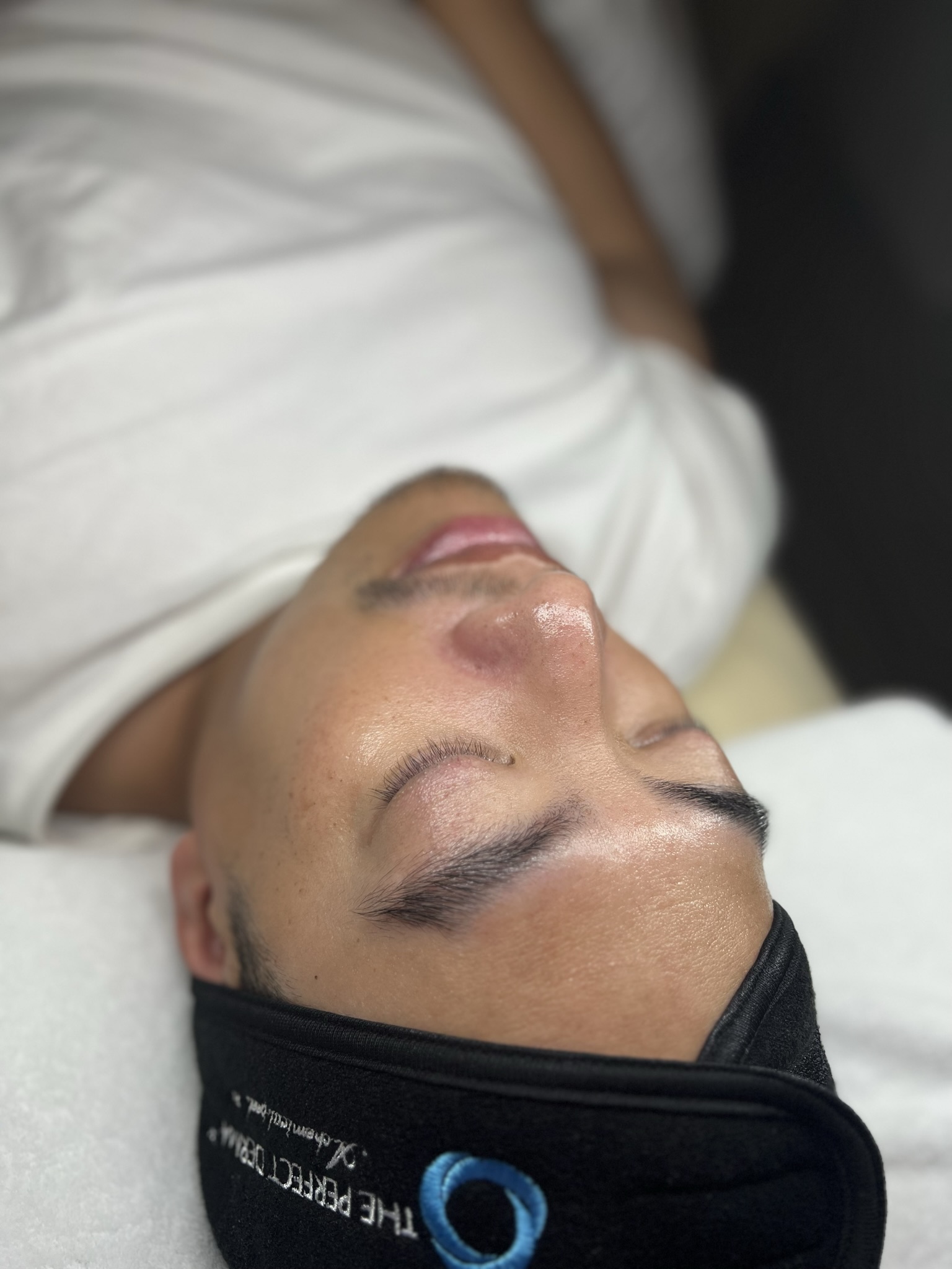 Client skin treatment photo 15