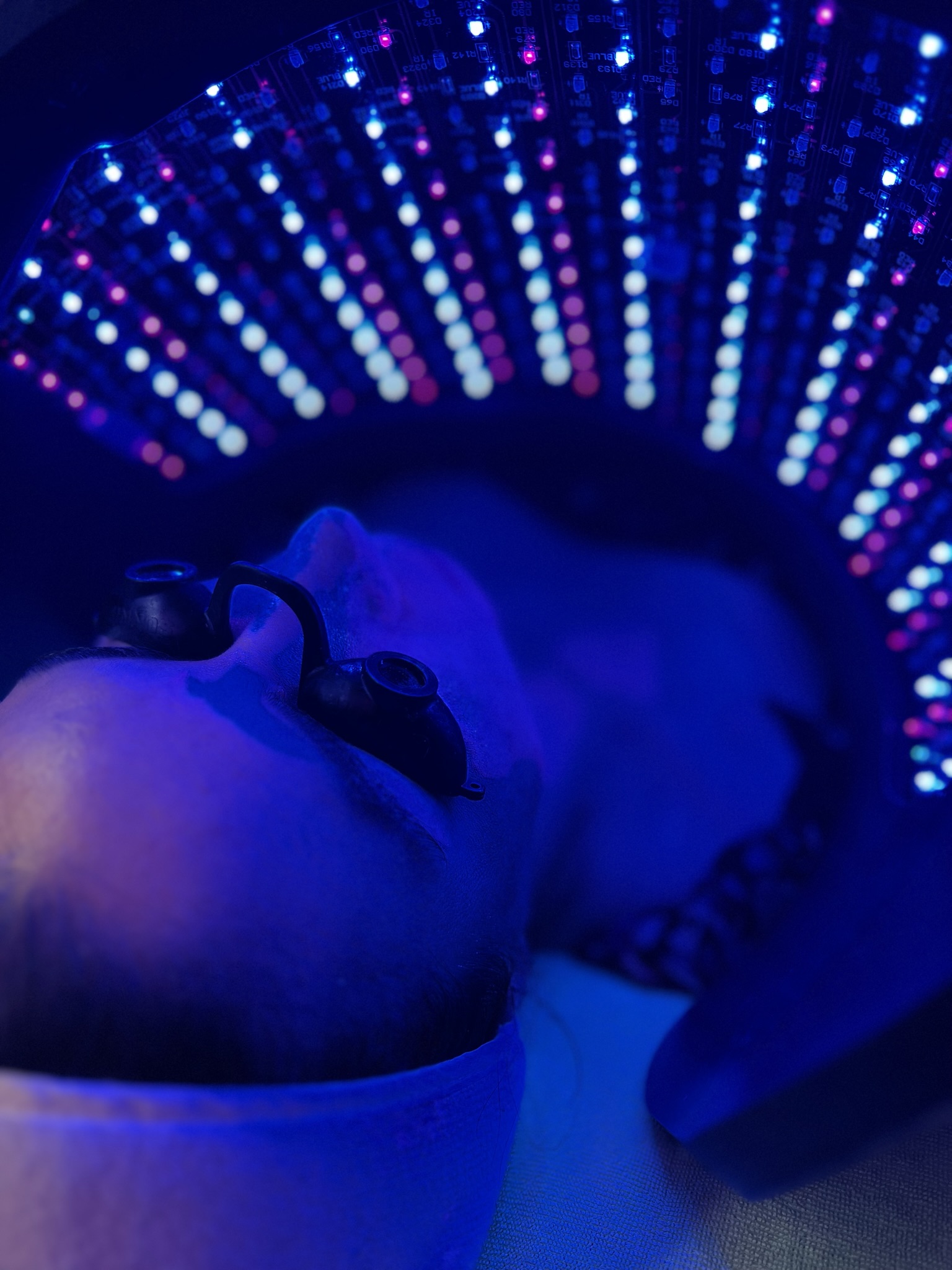 Client skin treatment photo 14