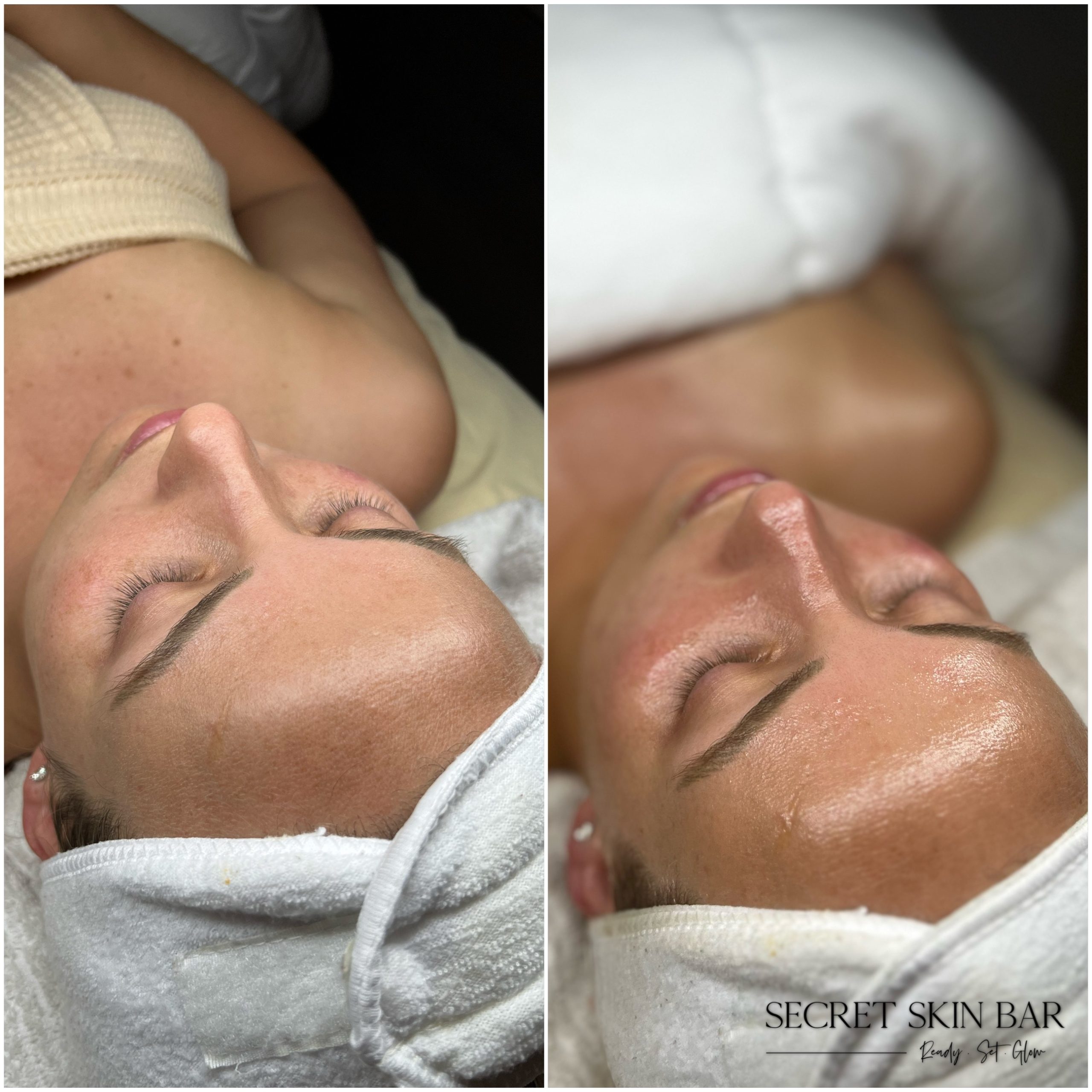 Client skin treatment photo 9
