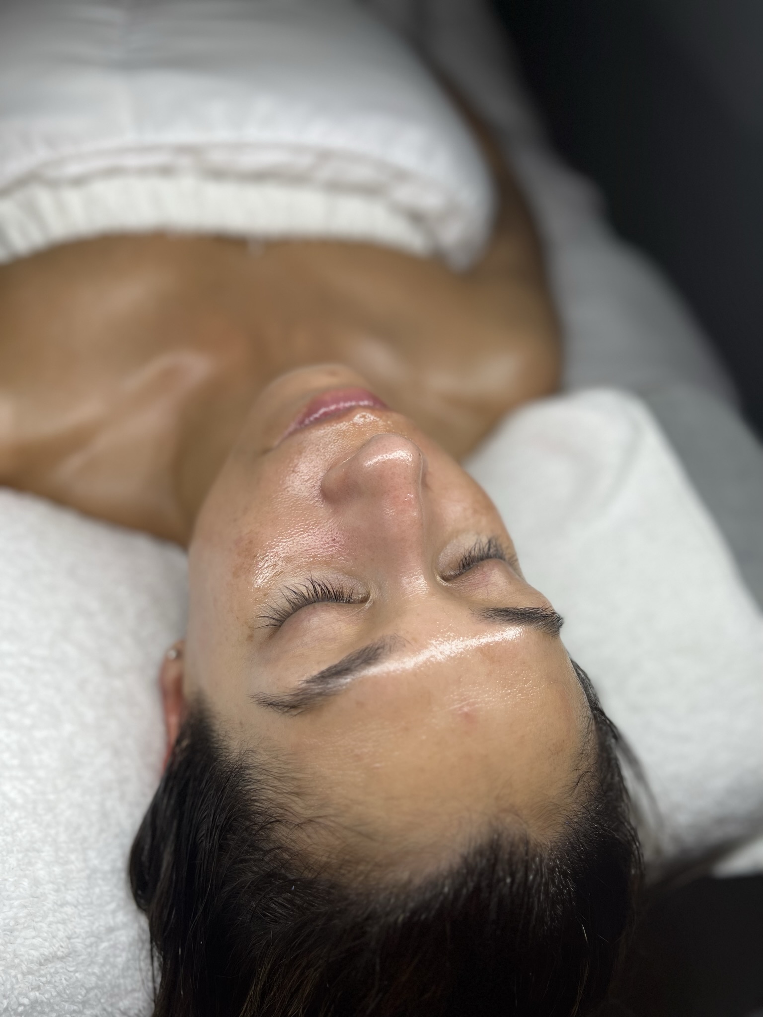 Client skin treatment photo 17