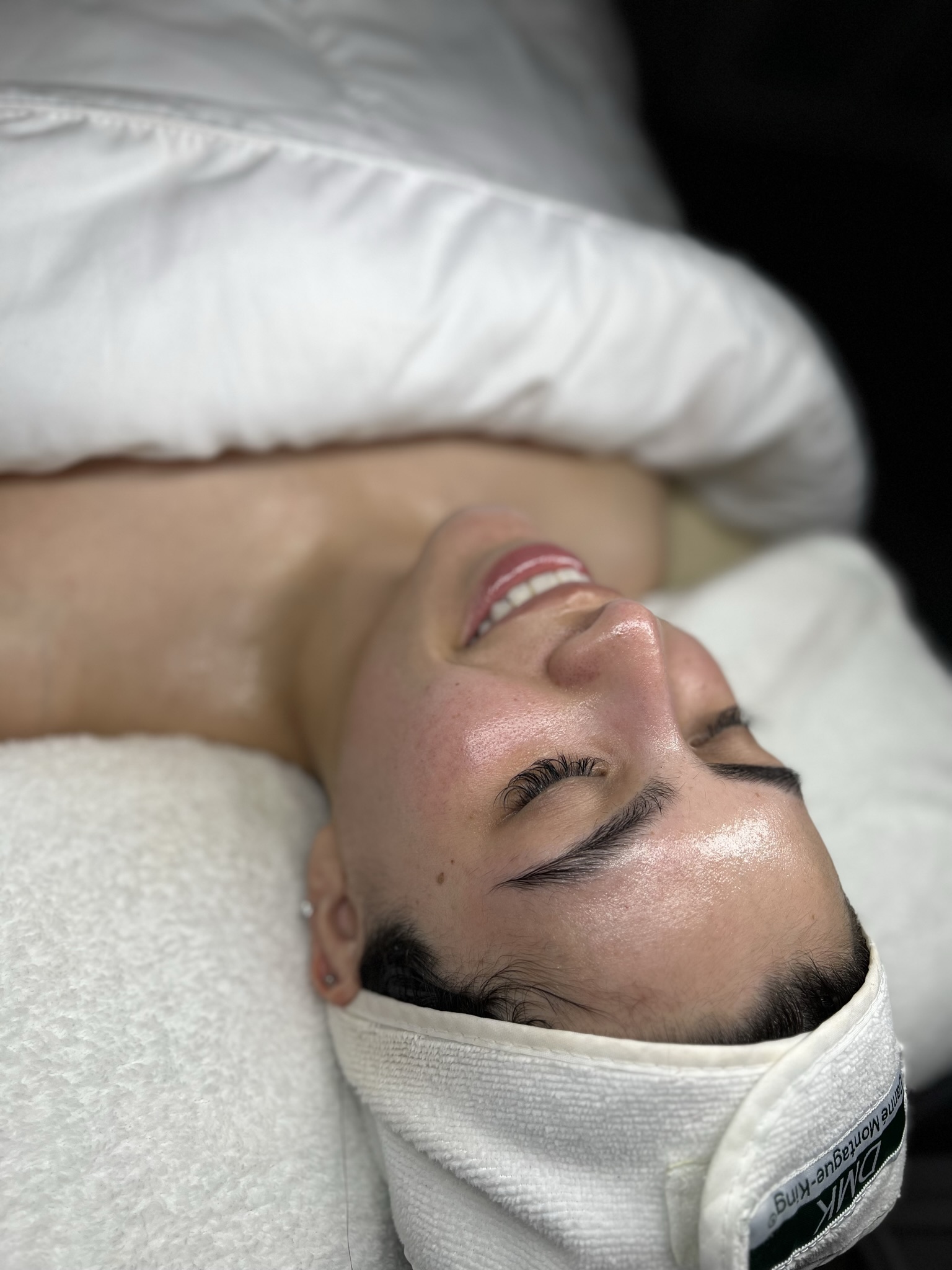 Client skin treatment photo 22