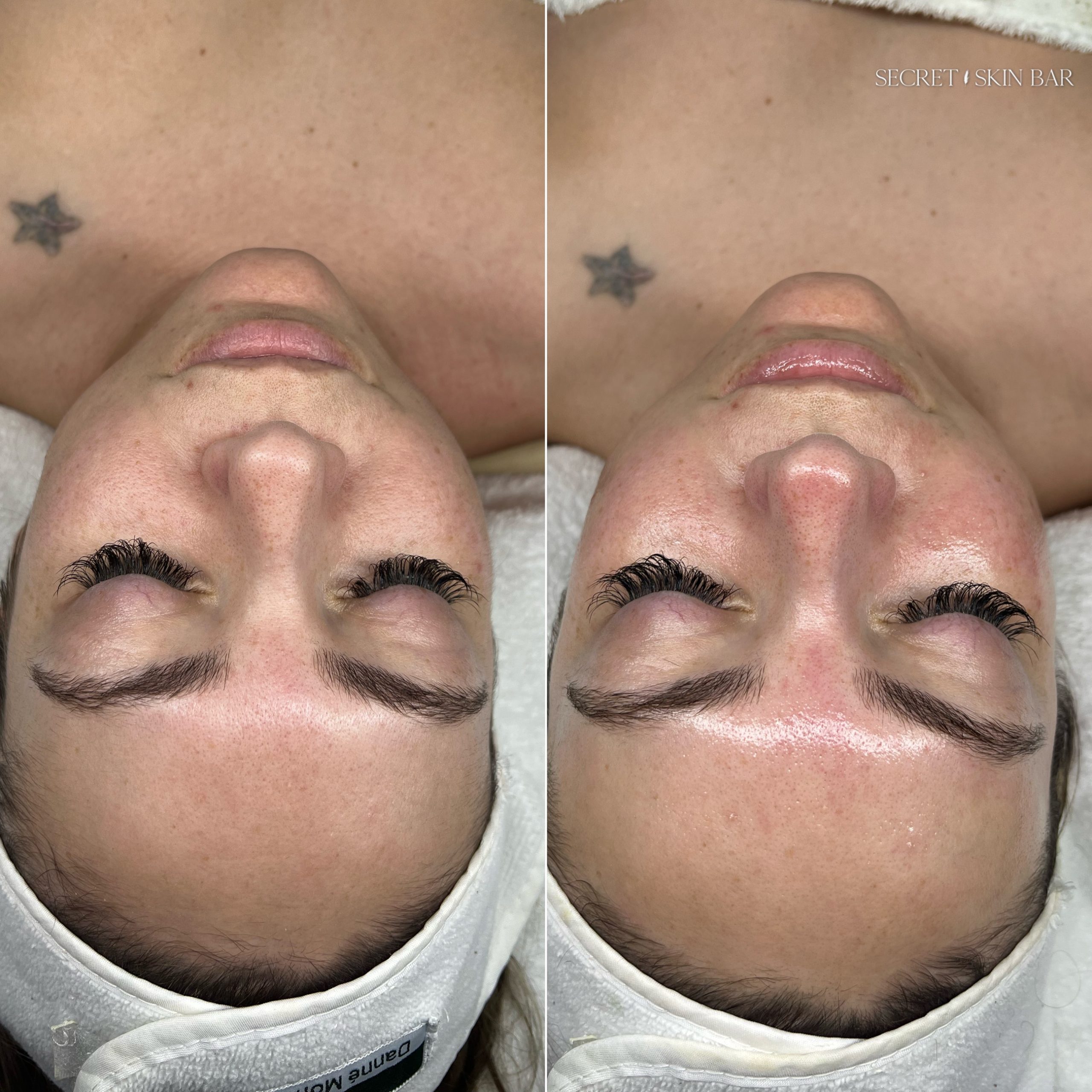 Client skin treatment photo 1