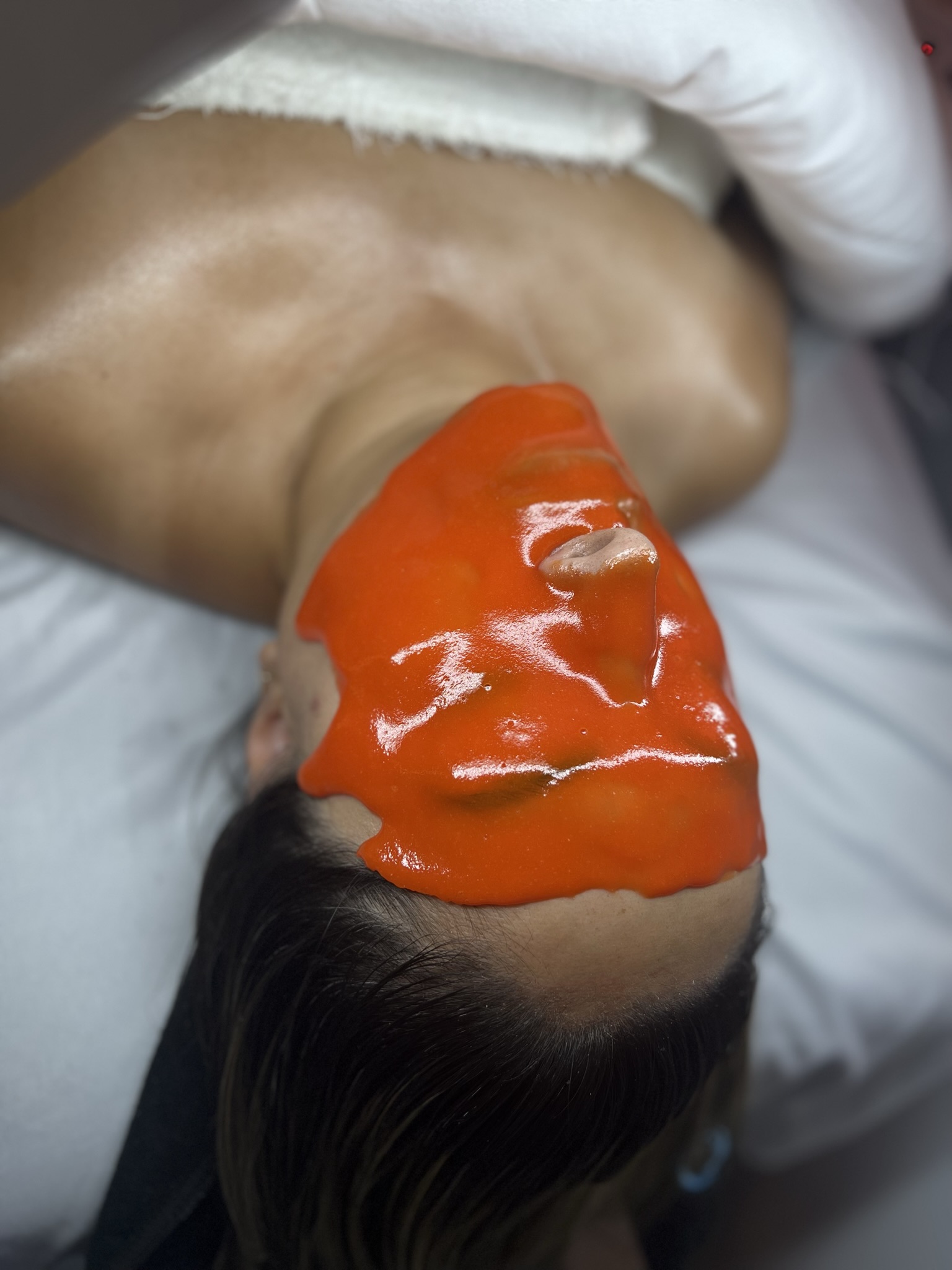 Client skin treatment photo 8